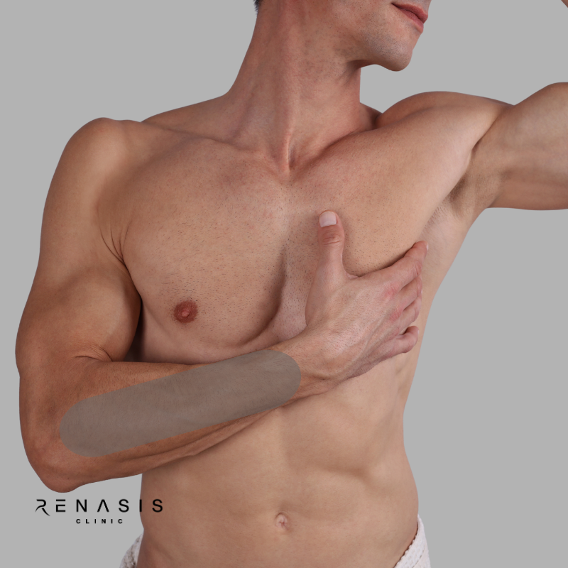 Antebrazo hombre | Depilación Láser