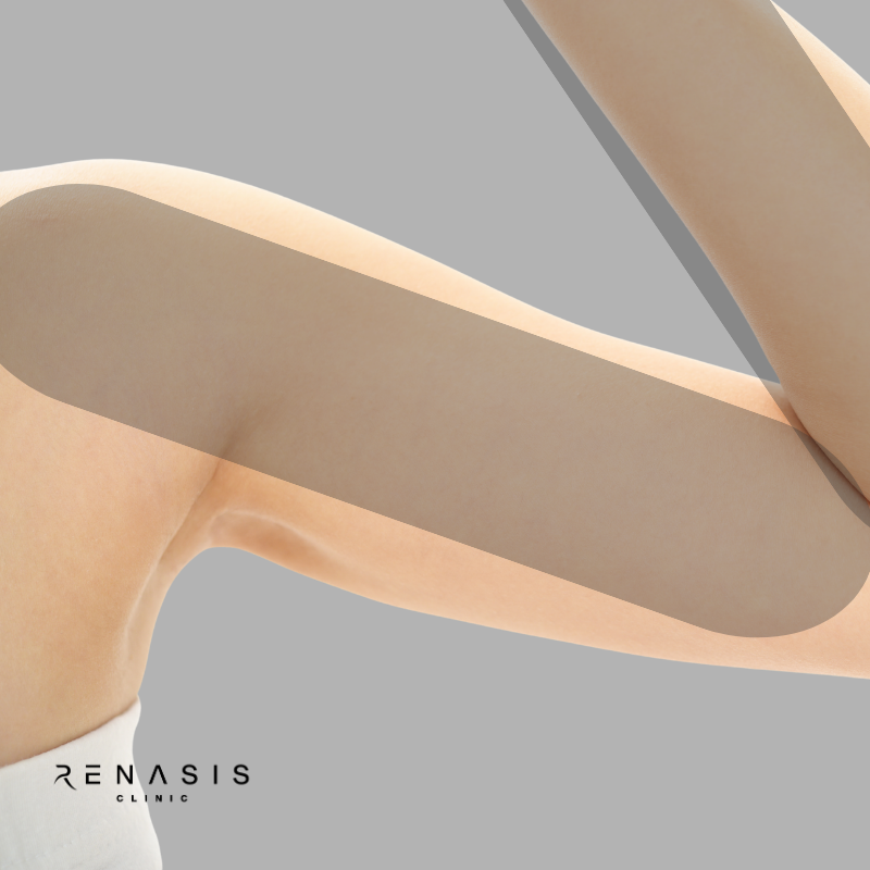 Brazo completo | Depilación Láser