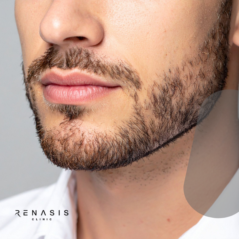 Cuello anterior hombre | Depilación Láser