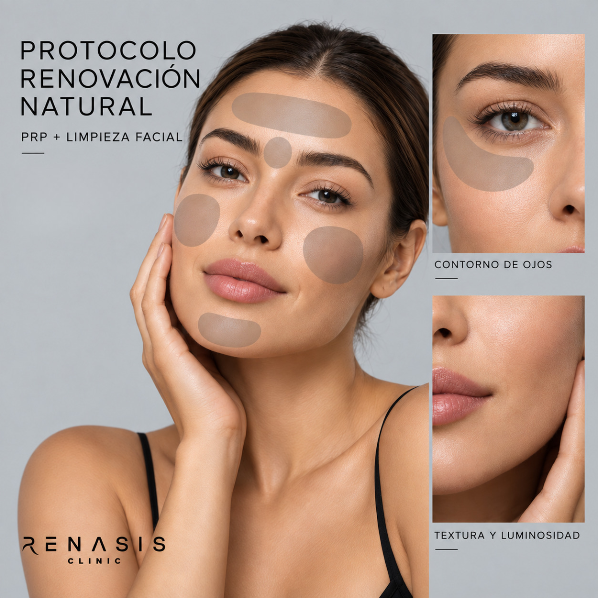 Protocolo Renovación Natural (PRP + Limpieza facial)