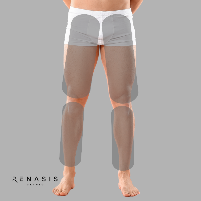 Piernas completas hombre | Depilación Láser
