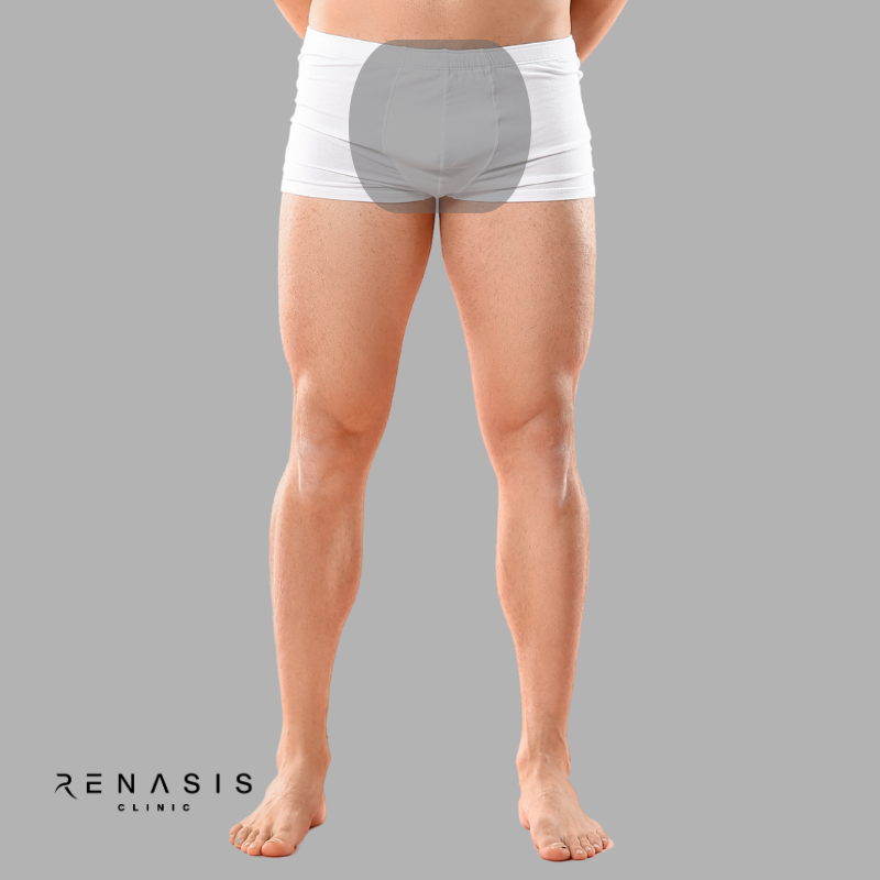 Rebaje total hombre | Depilación Láser