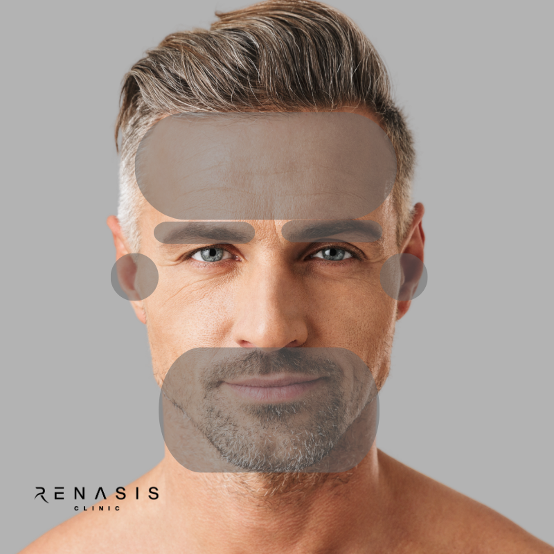 Rostro completo hombre | Depilación Láser