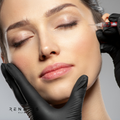 Toxina Botulínica Full Face + lifting mandibular y cuello