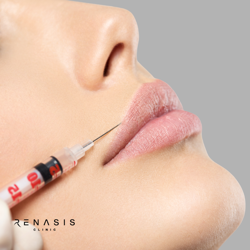 Aumento y perfilado de labios